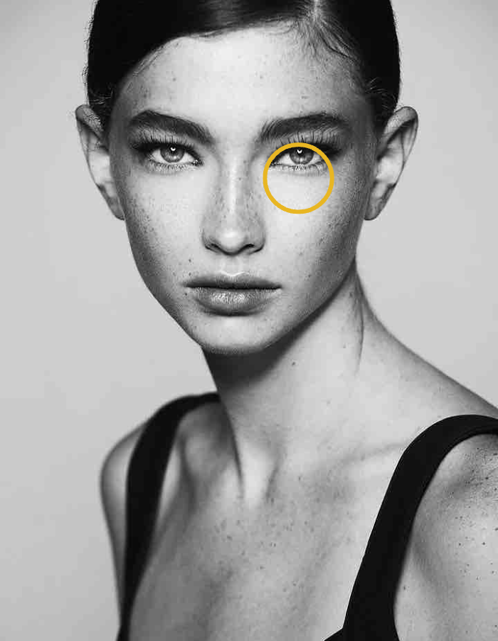 Brunette mit Sommersprossen Frau mit Kreismarkierung im Bereich Augenringe