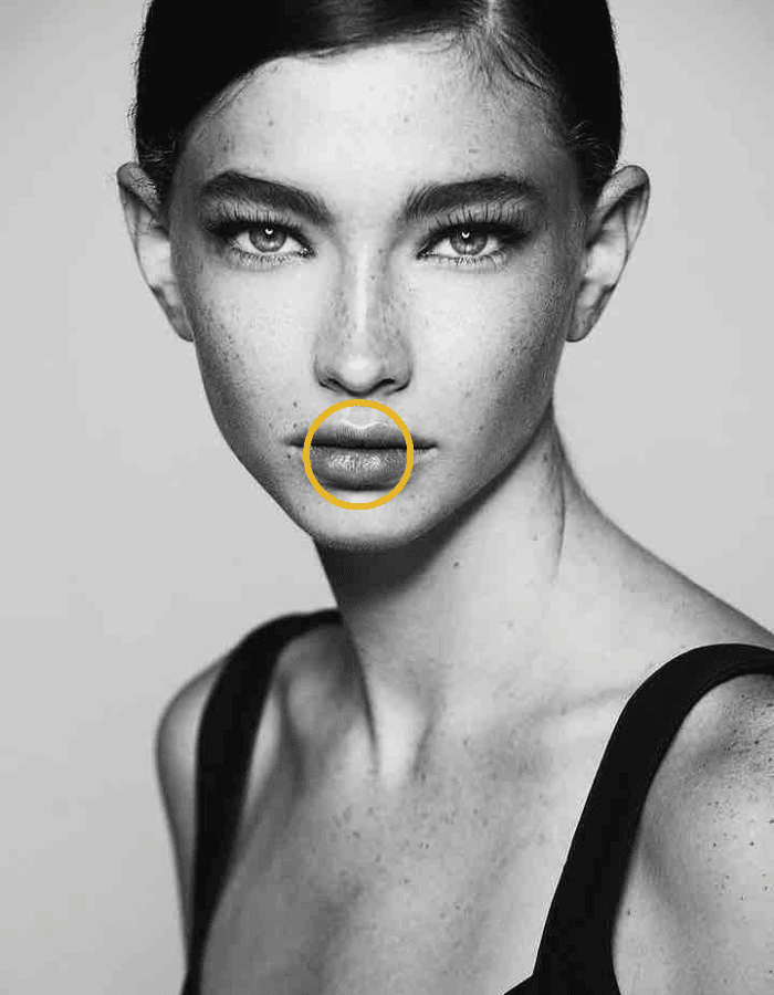 Brunette mit Sommersprossen Frau mit Kreismarkierung im Bereich Lippen / Lippenunterspritzung