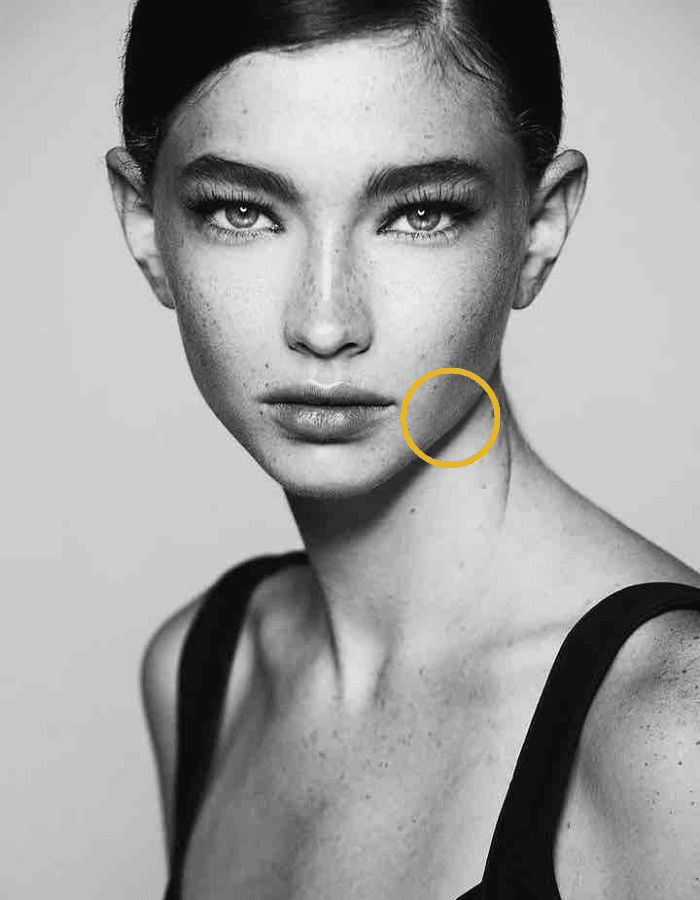 Brunette mit Sommersprossen Frau mit Kreismarkierung im Bereich Kinn und Jawline Korrektur