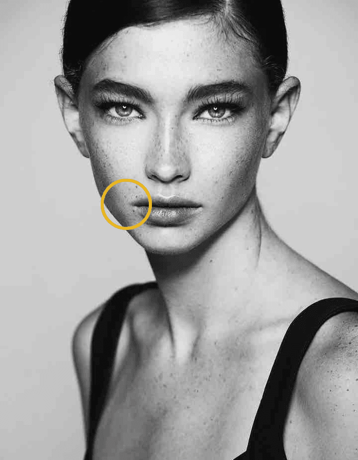 Brunette mit Sommersprossen Frau mit Kreismarkierung im Bereich Marionettenfalten / Mundwinkel