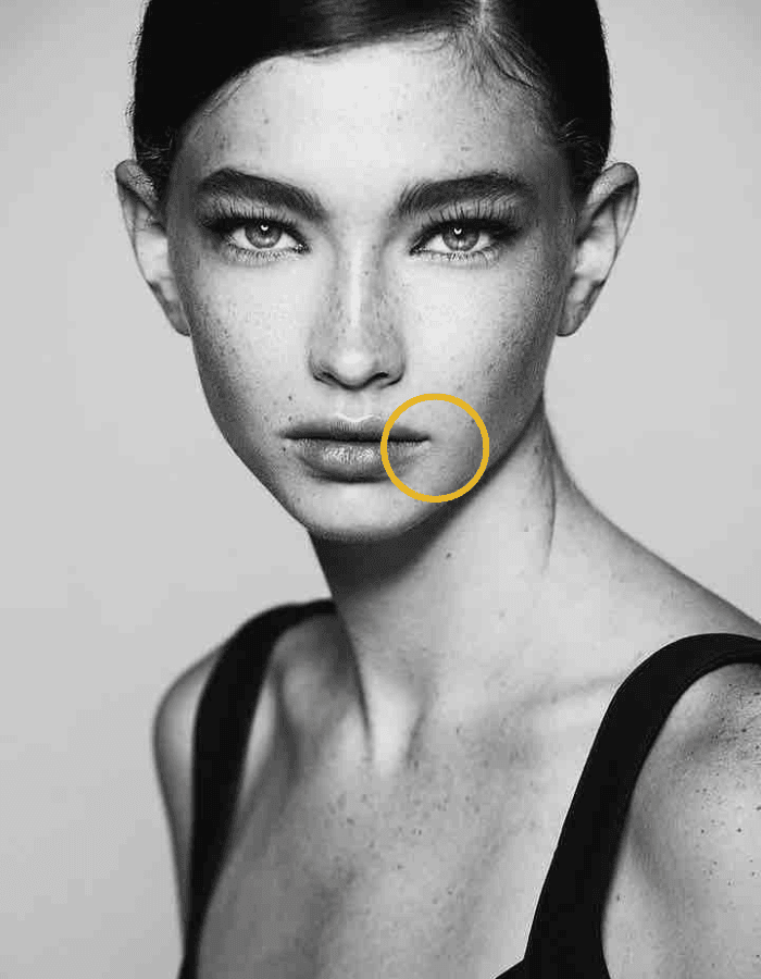 Brunette mit Sommersprossen Frau mit Kreismarkierung im Bereich Mundwinkel / Marionettenfalten