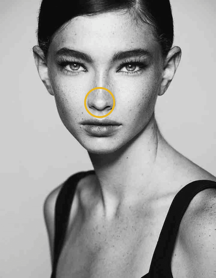 Brunette mit Sommersprossen Frau mit Kreismarkierung im Bereich Nasenspitze anheben ohne OP