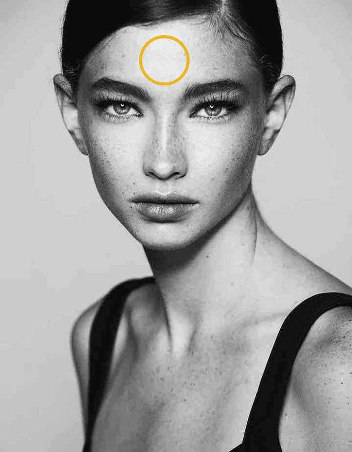 Brunette mit Sommersprossen Frau mit Kreismarkierung im Bereich Stirnfalten