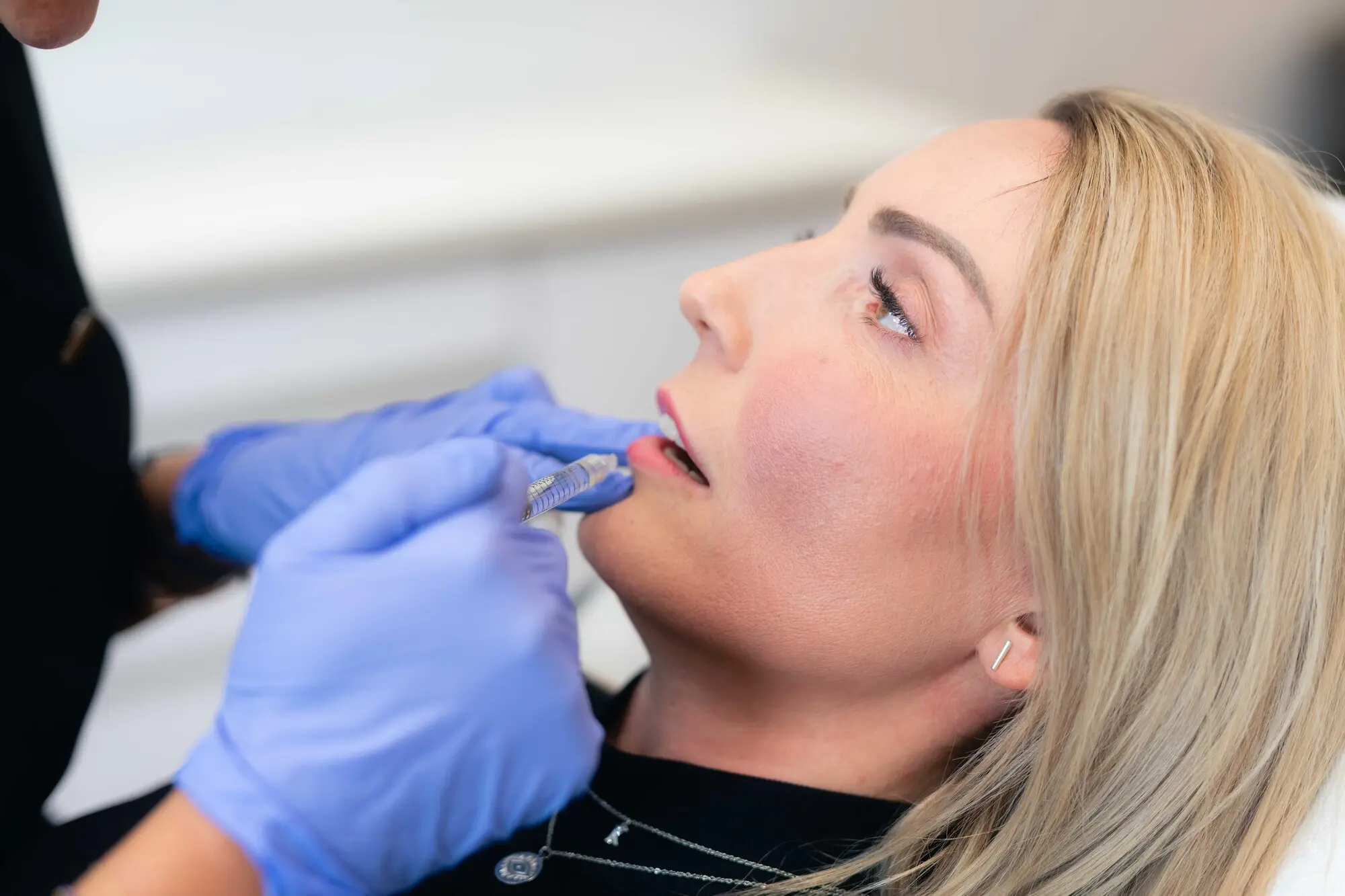 Blonde Frau beim Schönheitseingriff Lippen Berlin
